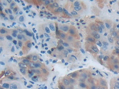 Polyclonal Antibody to Acetylcholinesterase (ACHE)