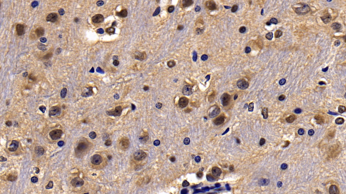 Polyclonal Antibody to Acetylcholinesterase (ACHE)