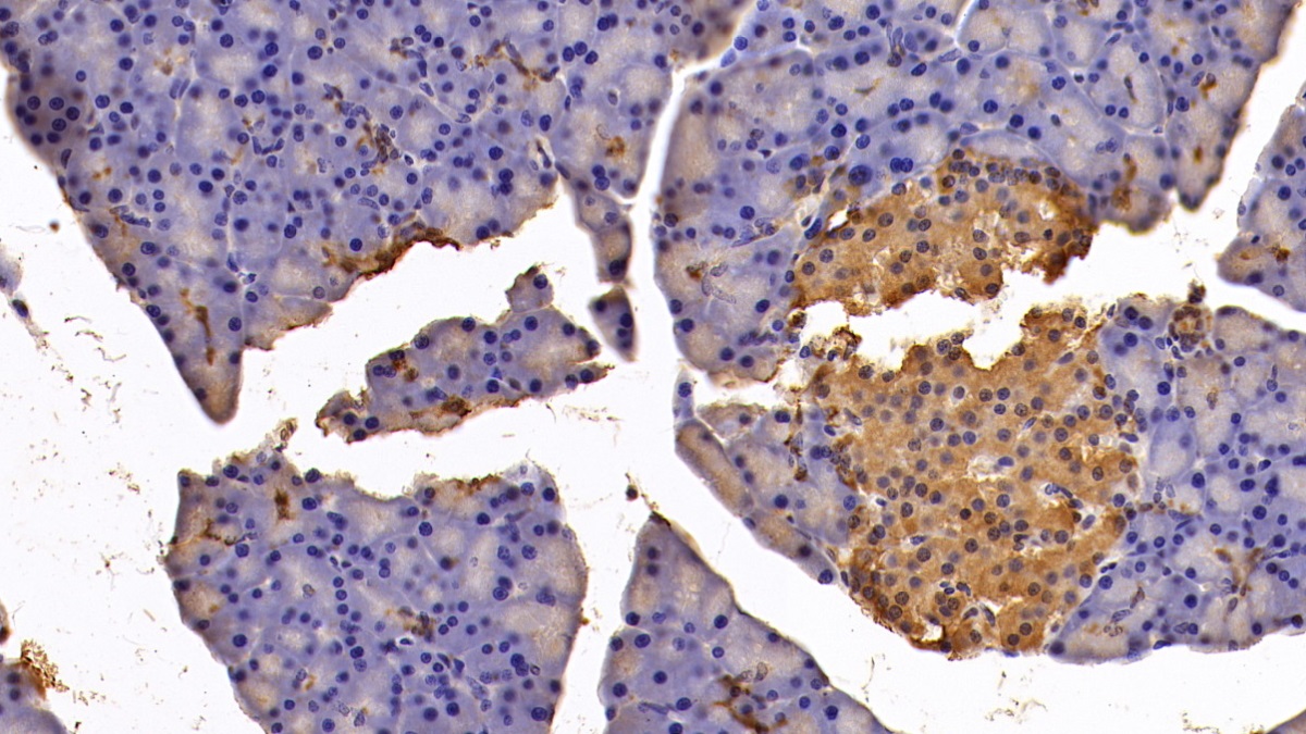 Polyclonal Antibody to Enolase 1 (ENO1)