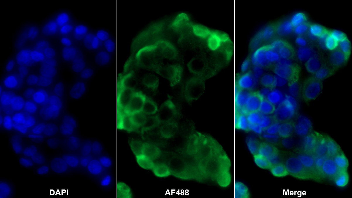 Polyclonal Antibody to Enolase 1 (ENO1)