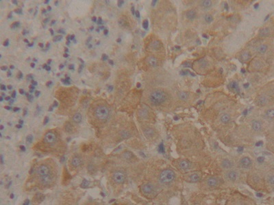 Polyclonal Antibody to Enolase 1 (ENO1)