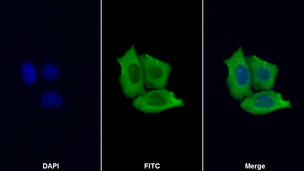 Polyclonal Antibody to Enolase 1 (ENO1)