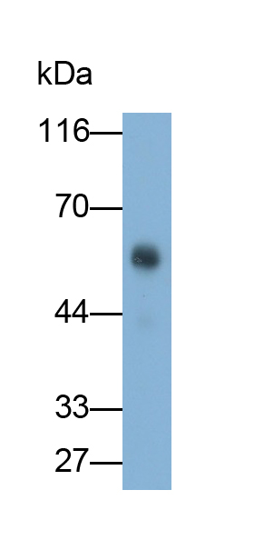 Polyclonal Antibody to Amylase, Alpha 2A (AMY2A)