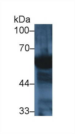 Polyclonal Antibody to Amylase, Alpha 2A (AMY2A)