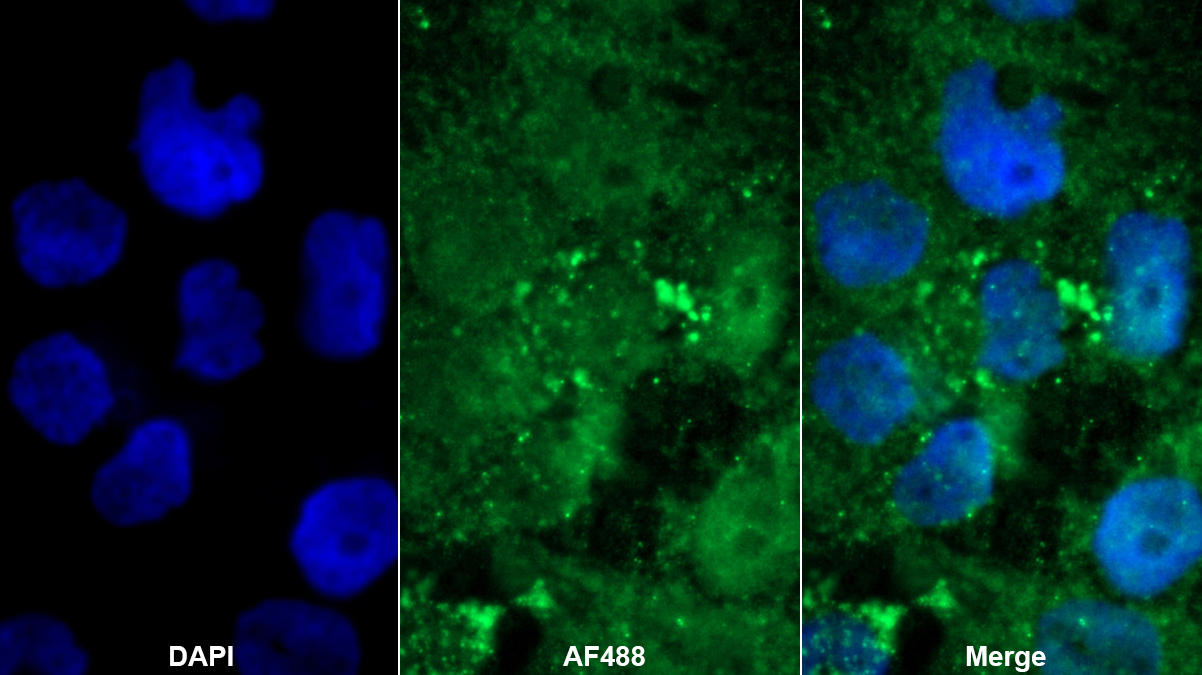 Polyclonal Antibody to MAP Kinase Activated Protein Kinase 2 (MAPKAPK2)