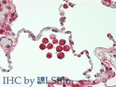 Polyclonal Antibody to Chitinase-3-like Protein 1 (CHI3L1)