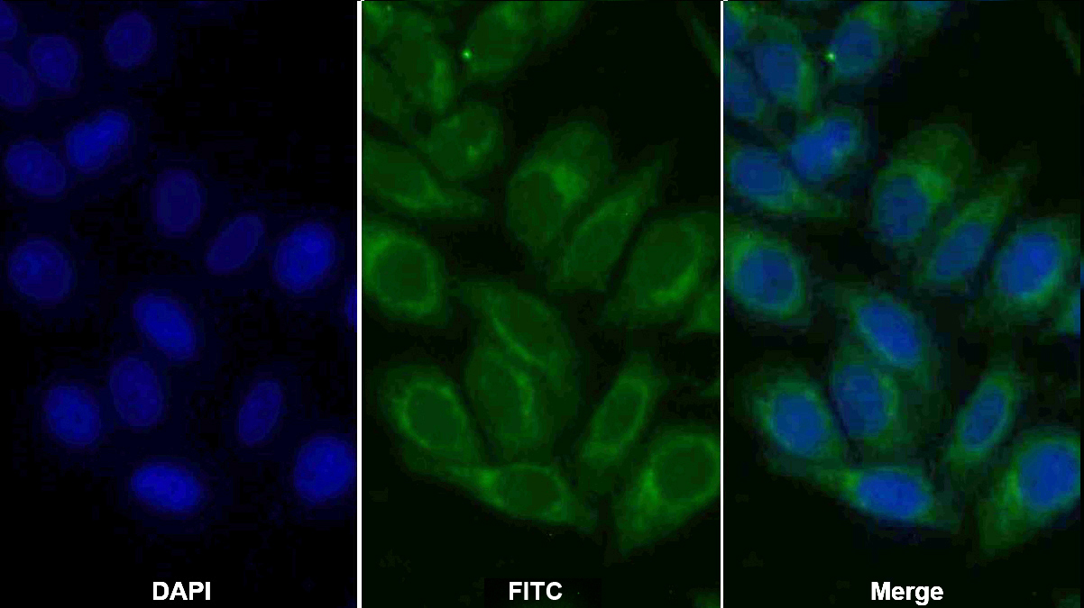 Polyclonal Antibody to Lysosomal Associated Membrane Protein 2 (LAMP2)