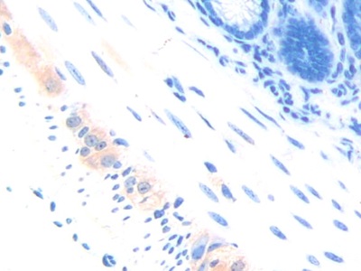 Polyclonal Antibody to Poliovirus Receptor Related Protein 3 (PVRL3)