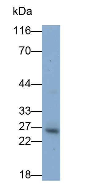 Polyclonal Antibody to Pancreatic Elastase 1 (ELA1)