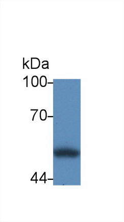 Polyclonal Antibody to Calreticulin (CALR)