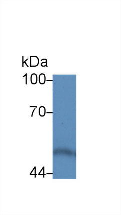 Polyclonal Antibody to Calreticulin (CALR)