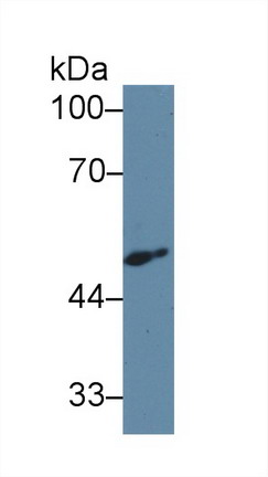 Polyclonal Antibody to Calreticulin (CALR)