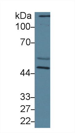 Polyclonal Antibody to Calreticulin (CALR)