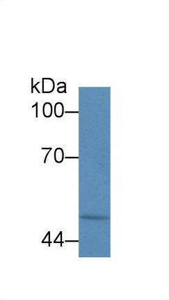 Polyclonal Antibody to Calreticulin (CALR)