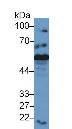 Polyclonal Antibody to Calreticulin (CALR)