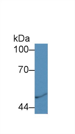 Polyclonal Antibody to Calreticulin (CALR)