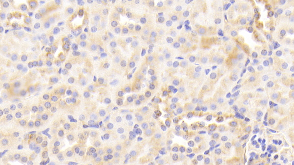 Polyclonal Antibody to Calreticulin (CALR)