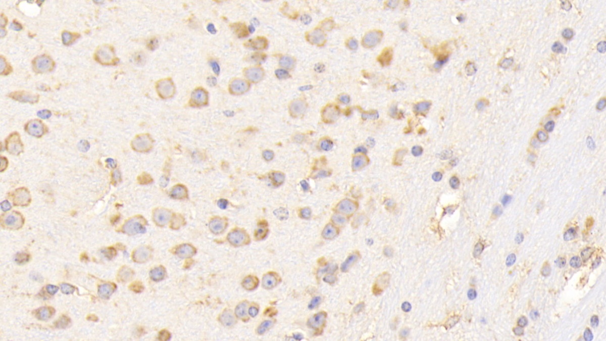 Polyclonal Antibody to Calreticulin (CALR)