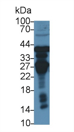 Polyclonal Antibody to Ornithine Transcarbamylase (OTC)