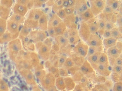 Polyclonal Antibody to Ornithine Transcarbamylase (OTC)