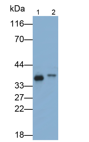 Polyclonal Antibody to Tumor Necrosis Factor Receptor 1 (TNFR1)