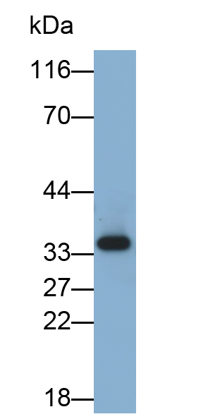 Polyclonal Antibody to Tumor Necrosis Factor Receptor 1 (TNFR1)