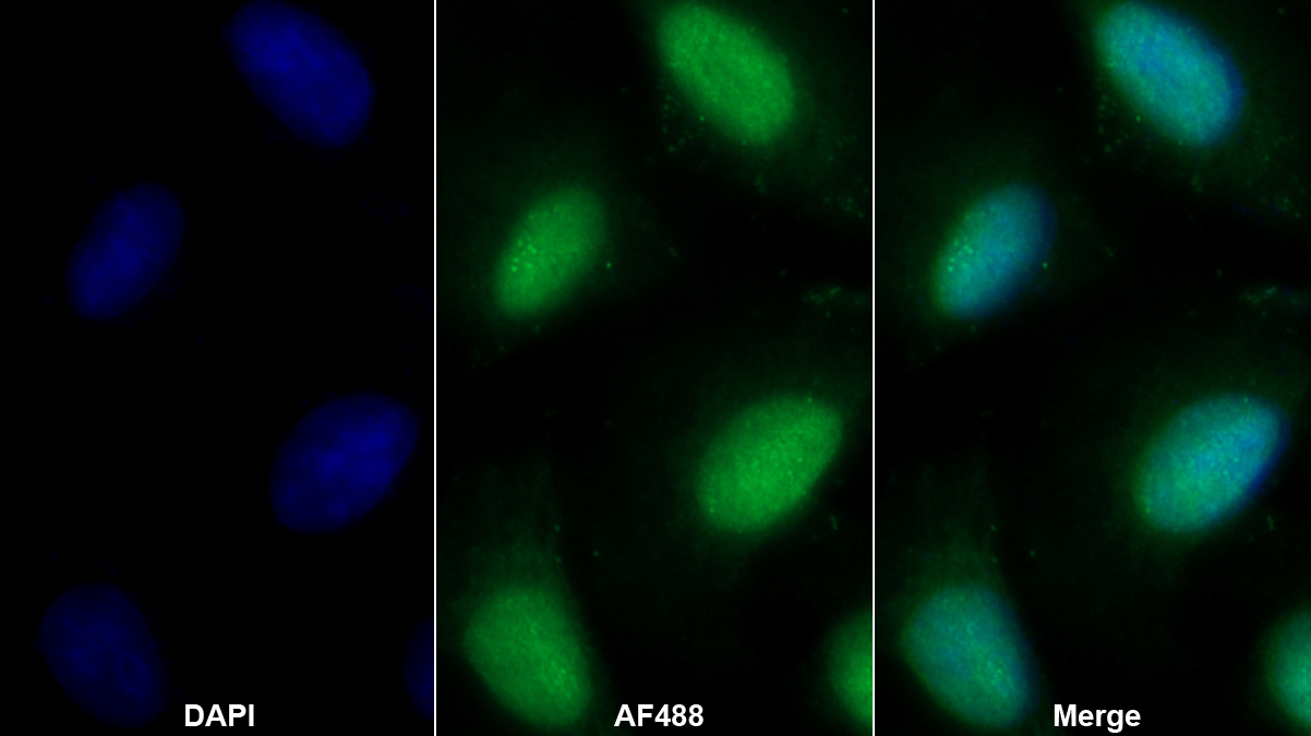 Polyclonal Antibody to General Transcription Factor IIE, Polypeptide 1 (GTF2E1)