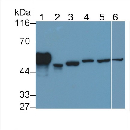 Polyclonal Antibody to Interleukin 1 Receptor Associated Kinase 2 (IRAK2)