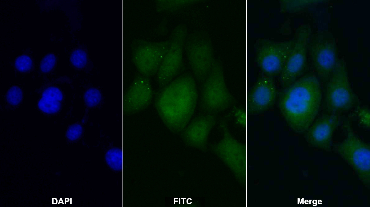 Polyclonal Antibody to Interleukin 1 Receptor Associated Kinase 3 (IRAK3)