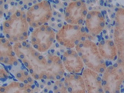 Polyclonal Antibody to Protease, Serine 2 (PRSS2)