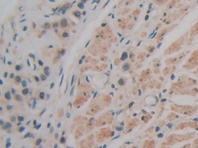 Polyclonal Antibody to Cluster Of Differentiation 147 (CD147)