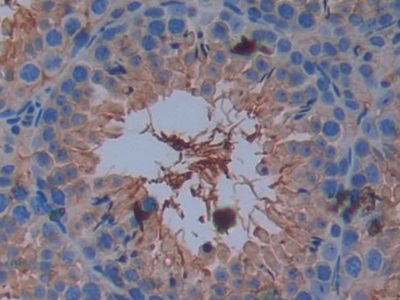 Polyclonal Antibody to Cluster Of Differentiation 147 (CD147)