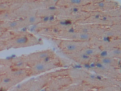 Polyclonal Antibody to Cluster Of Differentiation 147 (CD147)