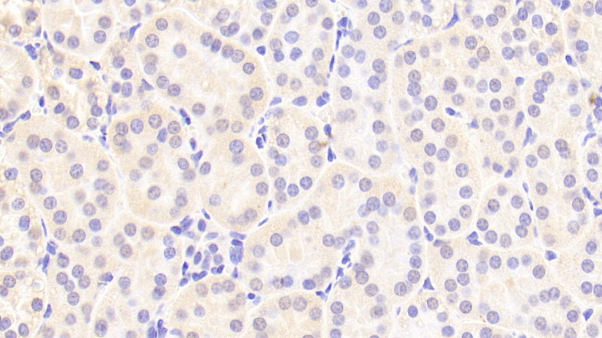 Polyclonal Antibody to Indoleamine-2,3-Dioxygenase (IDO)