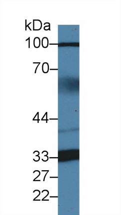 Polyclonal Antibody to Z-DNA Binding Protein 1 (ZBP1)