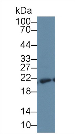 Polyclonal Antibody to Large Multifunctional Peptidase 7 (LMP7)