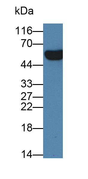 Polyclonal Antibody to Cytochrome P450 Family 21 Subfamily A Member 2 (CYP21A2)