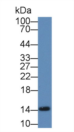 Polyclonal Antibody to Fatty Acid Binding Protein 1 (FABP1)