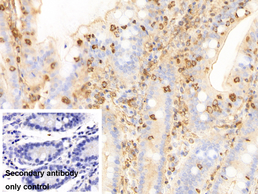 Polyclonal Antibody to Macrophage Scavenger Receptor 1 (MSR1)
