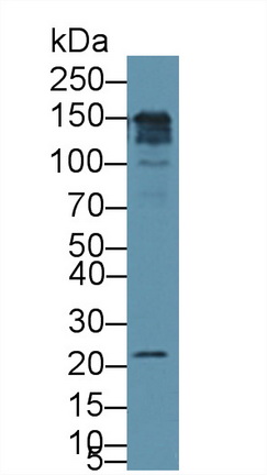 Polyclonal Antibody to Cluster Of Differentiation 164 (CD164)