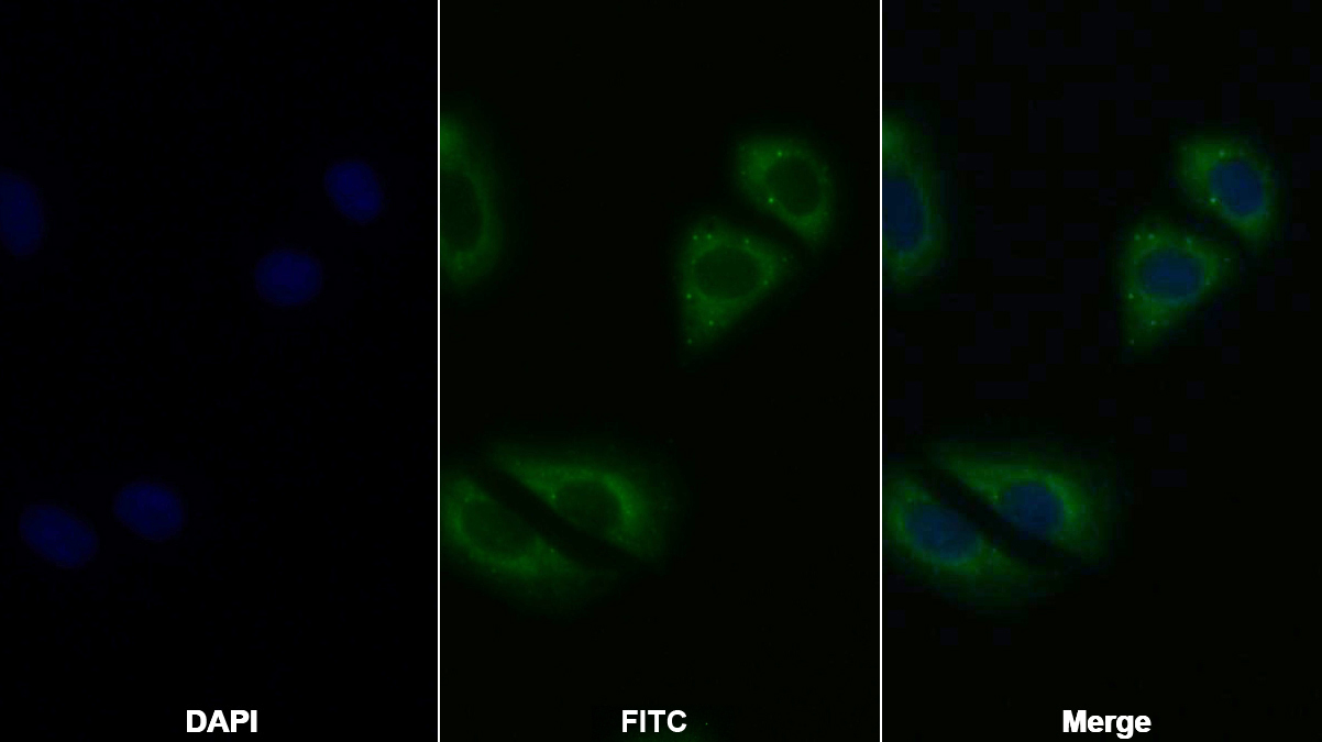 Polyclonal Antibody to Tyrosine Kinase 2 (Tyk2)