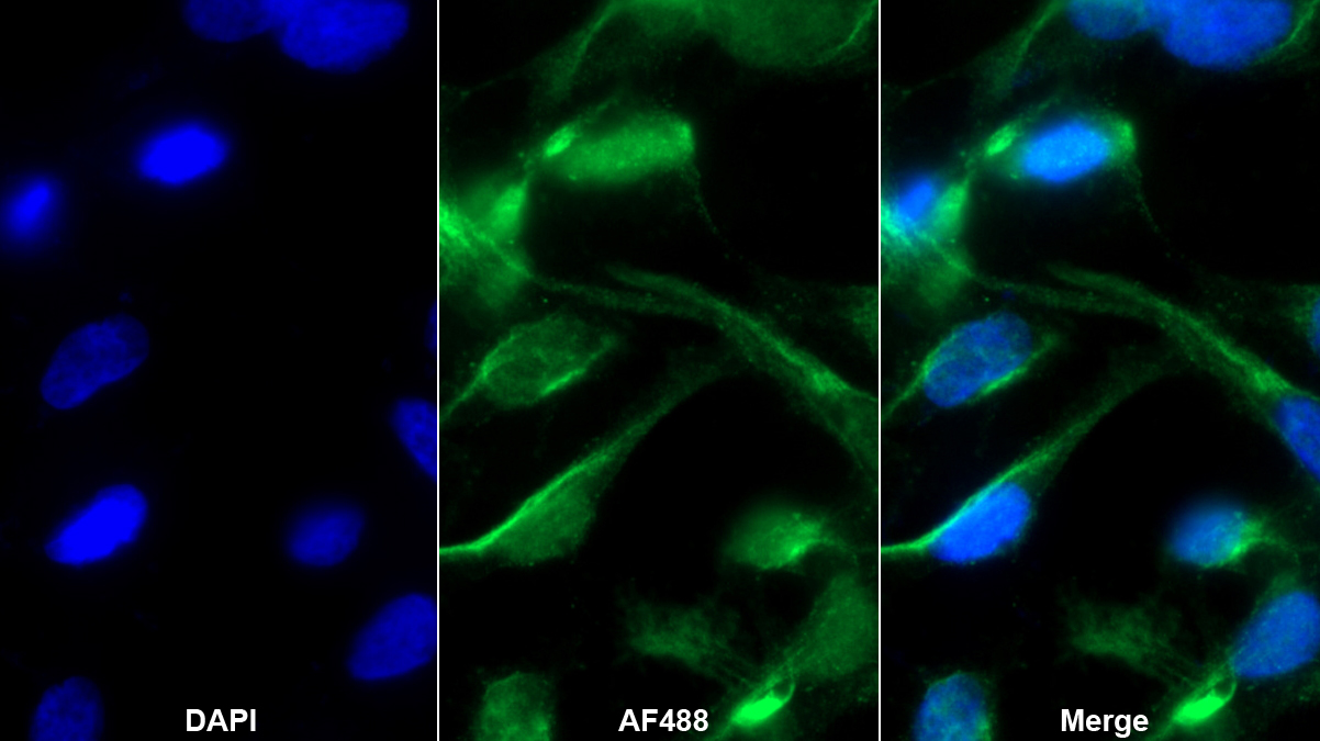Polyclonal Antibody to Chemokine (C-X-C Motif) Ligand 14 (CXCL14)