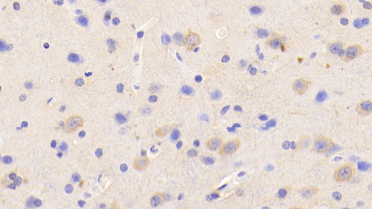 Polyclonal Antibody to Potassium Chloride Cotransporters 4 (KCC4)