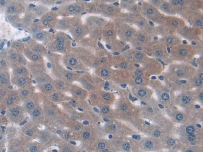 Polyclonal Antibody to Insulin Like Growth Factor 2 Receptor (IGF2R)