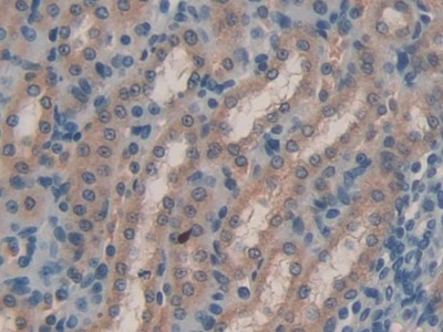 Polyclonal Antibody to Insulin Like Growth Factor 2 Receptor (IGF2R)