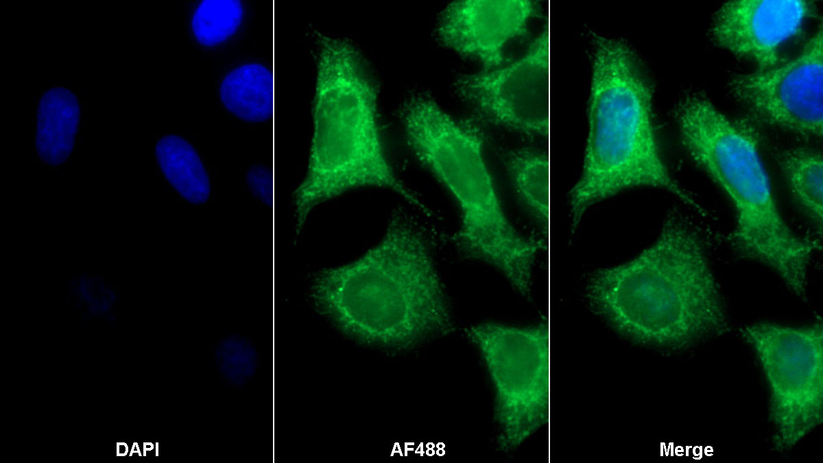Polyclonal Antibody to Electron Transfer Flavoprotein Beta Polypeptide (ETFb)