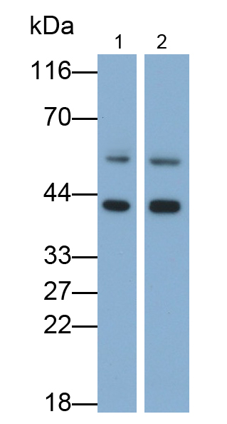 Polyclonal Antibody to Interleukin 13 Receptor Alpha 2 (IL13Ra2)