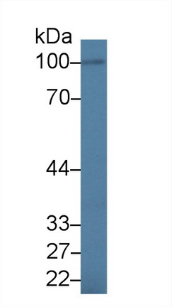 Polyclonal Antibody to Interleukin 17 Receptor A (IL17RA)