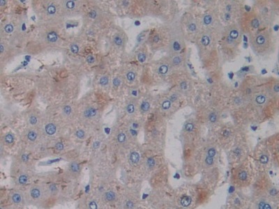 Polyclonal Antibody to Interleukin 17 Receptor A (IL17RA)