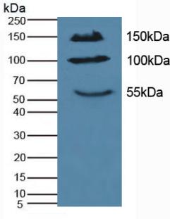 Polyclonal Antibody to Interleukin 17 Receptor A (IL17RA)